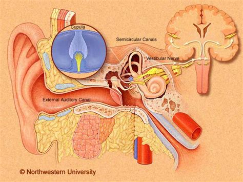 Lindsay-Hemenway Syndrome