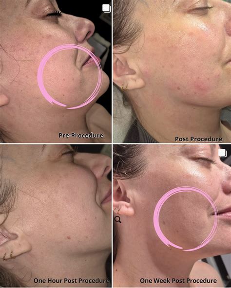 SpaJuvenation - Introducing the next generation in stem cells! Check