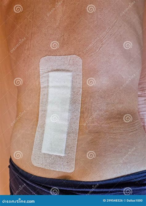 Big Plaster on Men S Back after Spine Operation - Herniated Discs