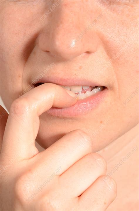 Fingernail Biting - Stock Image - C030/7037 - Science Photo Library
