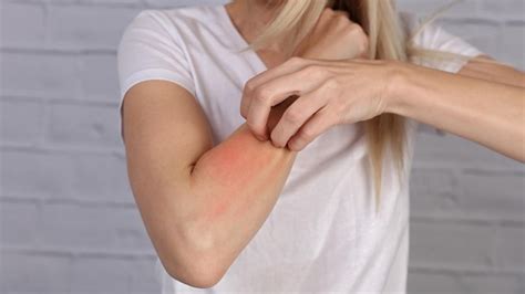 cuando  picor es mucho mas   picor  puede ser aviso de cancer