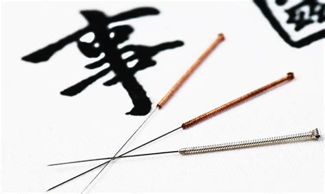 Acupuntura e MTC – Acupuntura e Medicina Tradicional Chinesa