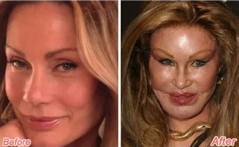 Jocelyn Wildenstein Plastic Surgery Gone Wrong! Before After