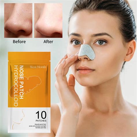 Unbelievable Blackhead Removal 2024: The Dermatologist's Secret Weapon! Image 18