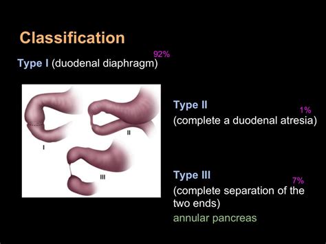 Duodenal atresia
