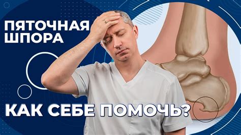 Димексид при пяточной шпоре - особенности, противопоказания