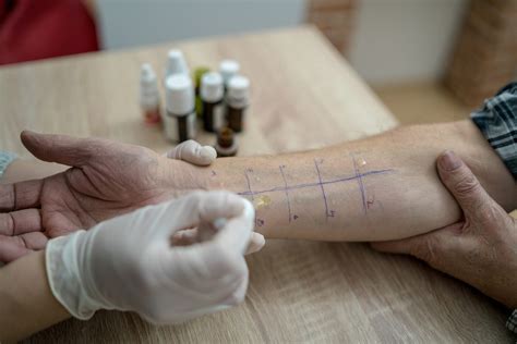 Cosa sono e come funzionano le allergie stagionali