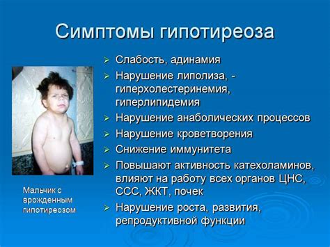 Врожденный гипотериоз | Справка.Неинвалид.ru