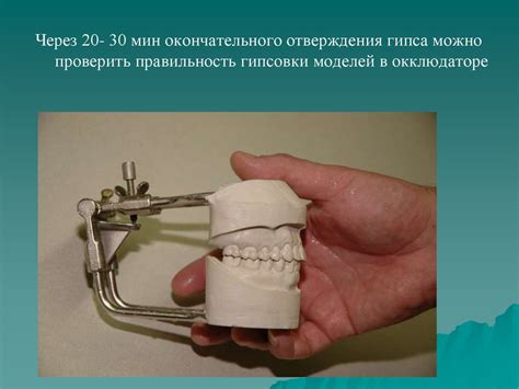 Фиксация моделей в окклюдатор - презентация онлайн