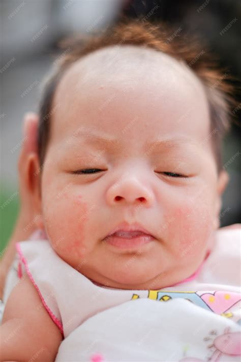 Premium Photo | Portrait of a newborn baby close-up. face baby rashes