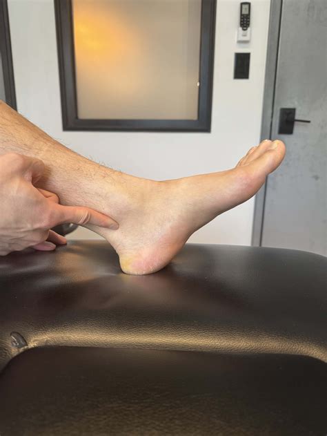 Posterior Tibial Tendon Tear Surgery With Images