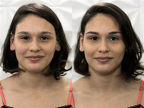 Preenchimento Temporas Antes E Depois