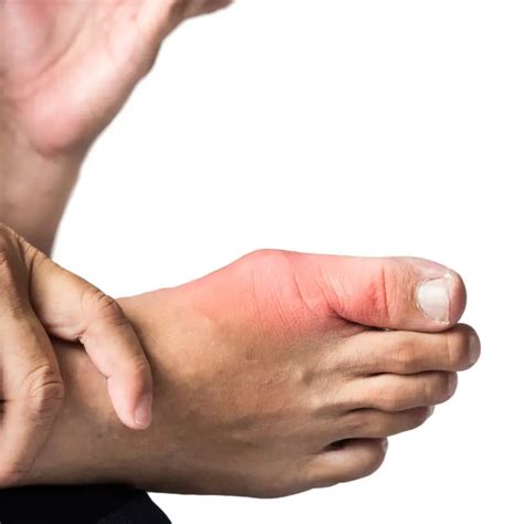 minute hallux rigidus exercises liebscher bracht