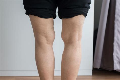 ORTHOPEDICS – Anatolian Health