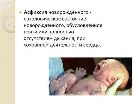 Причины нарушений речи у детей - презентация онлайн