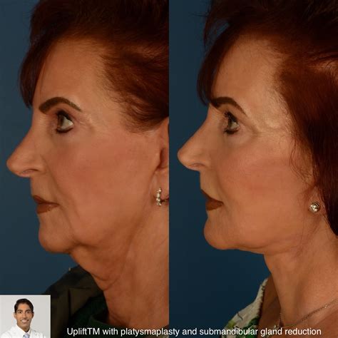 Aesthetic Surgery Center | Naples FL