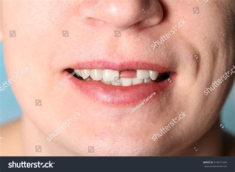man  teeth images stock  vectors shutterstock
