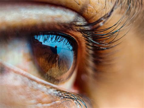 does medicare cover glasses after cataract surgery 9