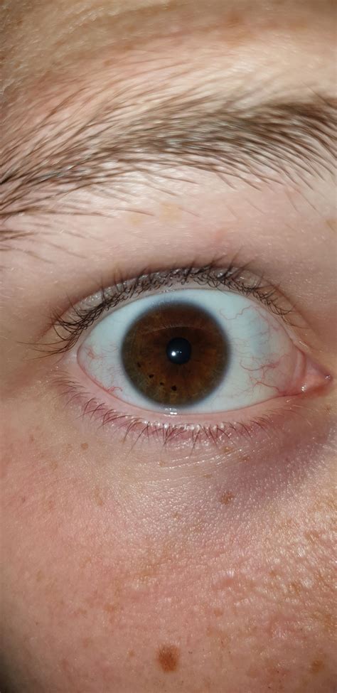 I have four dots in my eye. : r/eyes
