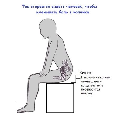 Болит копчик, когда сидишь и встаешь: причины и лечение
