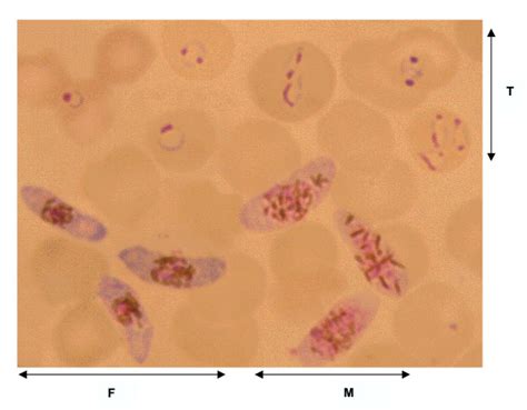 Mature female (F) and male (M) gametocytes and trophozoites (T) of ...