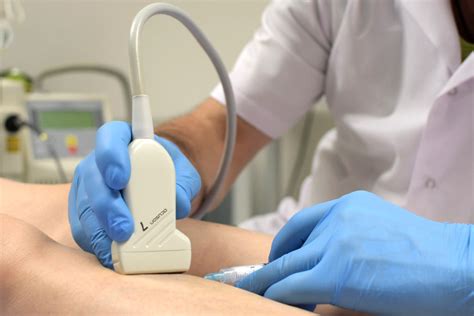 Skleroterapia piankowa - leczenie żylaków telangiektazji | Venavita Poznań