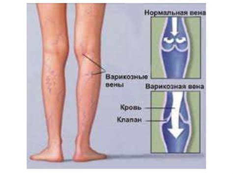 Специальные методы исследования вен - презентация онлайн