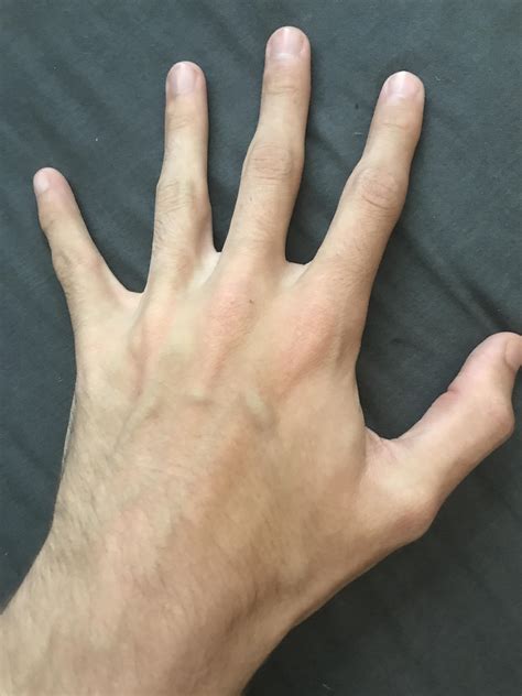 One hand : r/hands