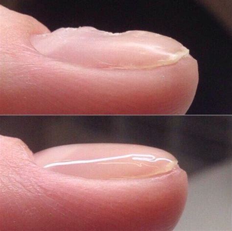 Выравнивание ногтевой пластины | imkosmetik журнал