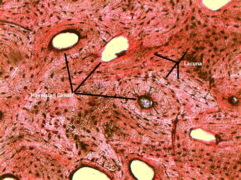 Bone Cross Section Slide Labeled : Compact Bone 10x Labeled Histology ...