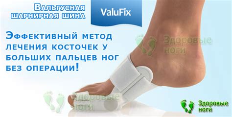 Шарнирная вальгусная шина Валюфикс (Valufix) - купить ортопедический ...