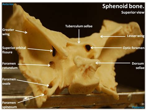 Optic Canal Sphenoid Bone at Abbie Patterson blog