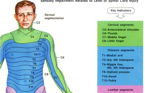 Chasing the pretty rainbow: Dermatome