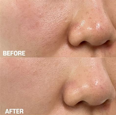 PORE MINIMIZING 21 SERUM | K-Shop Cosmetics