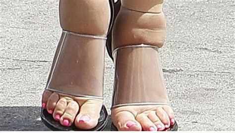 shoes work   swollen feet  ankles comfort clinic
