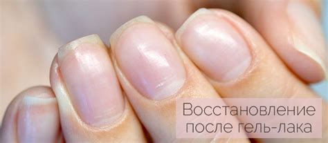 Восстанавливаем ноготки: лечебный лак для ногтей после гель лака.