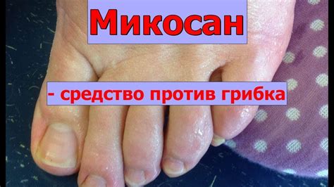 Микосан - от грибка ногтей, таблетки, крем и отзывы - YouTube