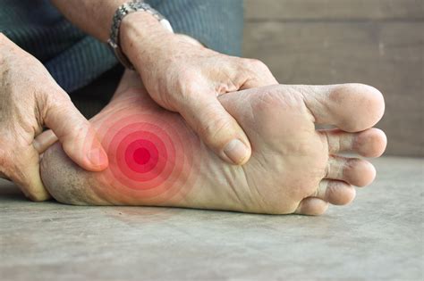 Fascite Plantar: Causas, Sintomas, Tratamento e Opções