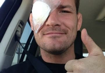 Michael Bisping Eyes Bout with Cung Le After Eye Heals | BJPenn.com