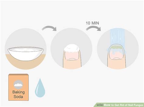 how to get rid of nail fungus quickly