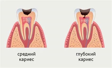 Беременность и зубы | Пикабу