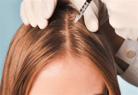 Мезотерапия для волос и кожи головы Dermaheal HL
