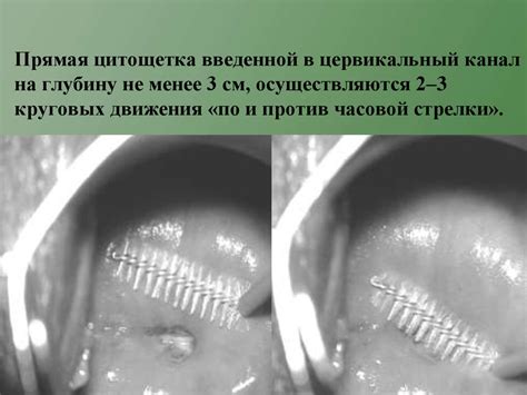 Цитологическое исследование патологии шейки матки - презентация онлайн