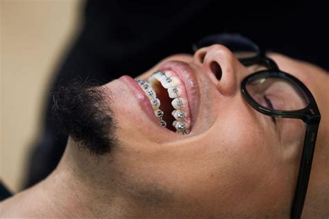 dos donts  wearing braces saddle creek orthodontics