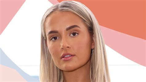 Molly Mae Plastic Surgery: Has The Love Island Alum Had Cosmetic Surgery?