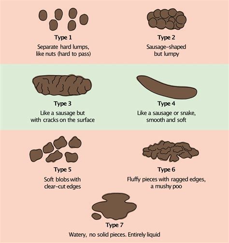 IBS poo chart (Bristol Stool Chart for IBS) - IBS Clinics