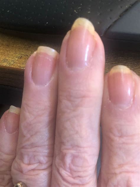 NAIL DEFENSE – ORLY