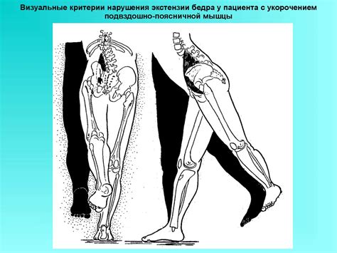 Мышцы поясницы - презентация онлайн