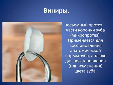 Современные методы изготовления виниров - презентация онлайн