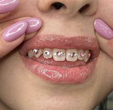 arttttttsss on ig | Tooth gem, Diamond teeth, Pretty teeth